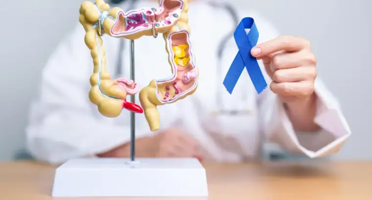 Deteksi Dini Kanker Usus Besar: Gejala, Penyebab, dan Faktornya